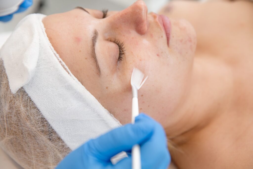 provider spreading a chemical peel on a woman's face