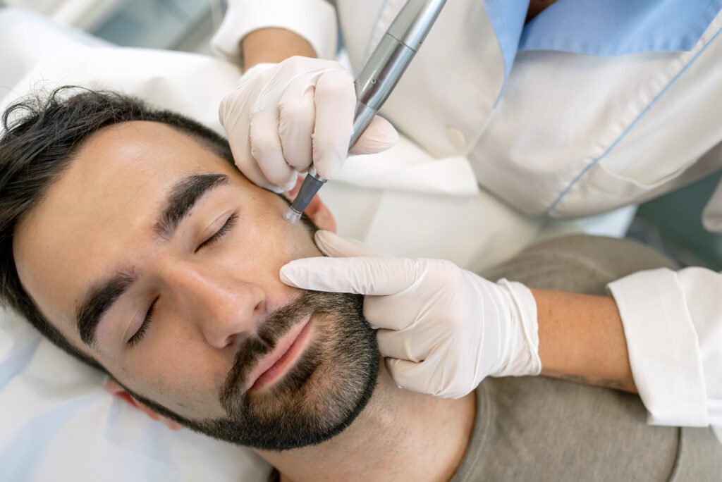 Man receiving Acne Scar treatment and other Aesthetician Services