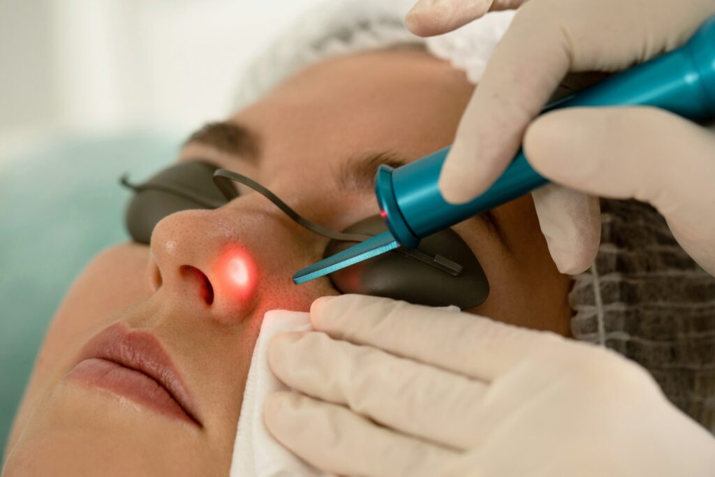 Laser Treatments